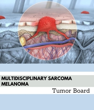 Multidisciplinary Sarcoma Melanoma Tumor Board Banner